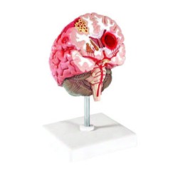 Brain Models